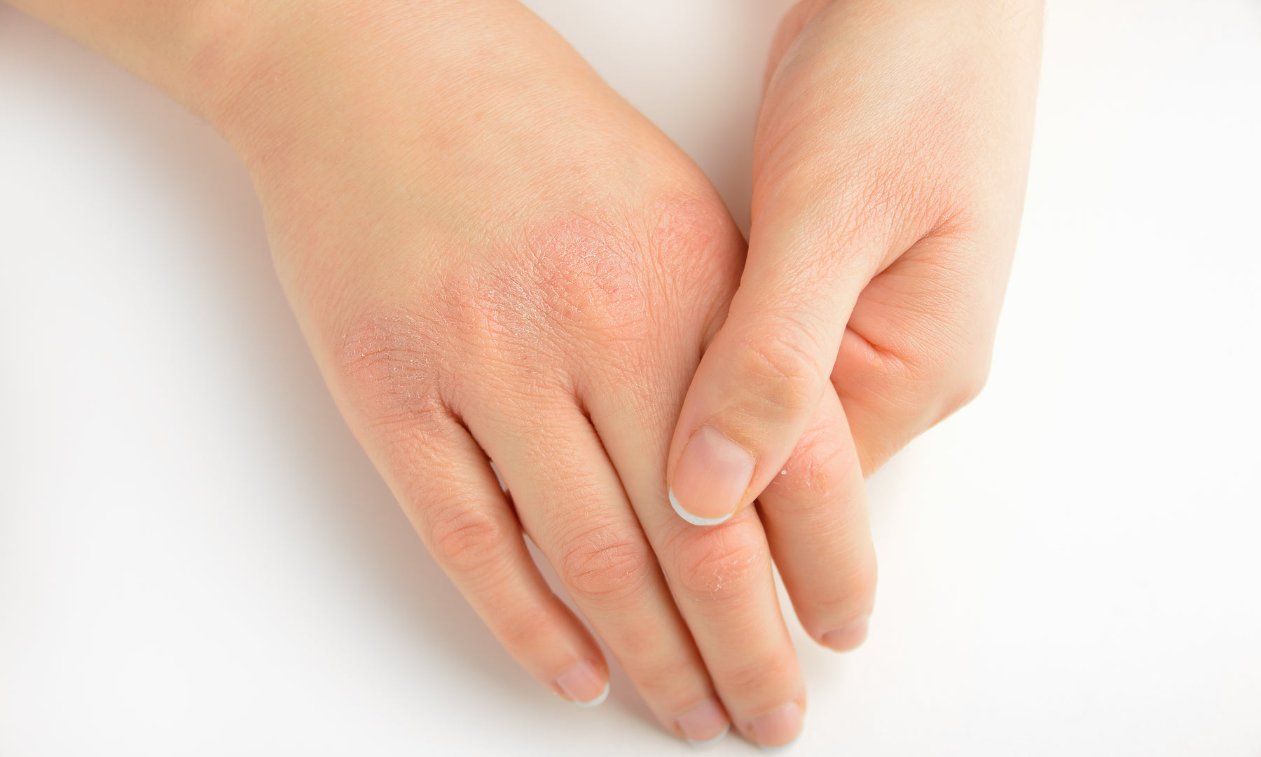 8 Ways to Avoid Dry Hands