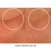 Neck & Décolleté Cream