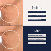 Neck Hydroseal™ Patch