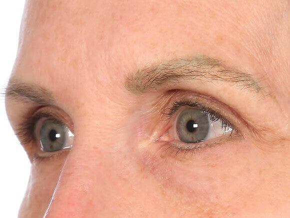 After image