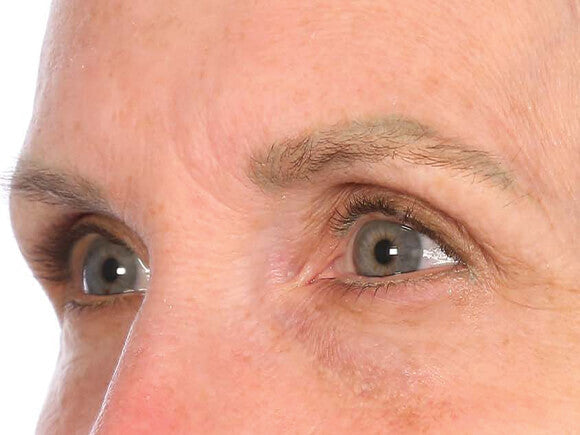 Before image