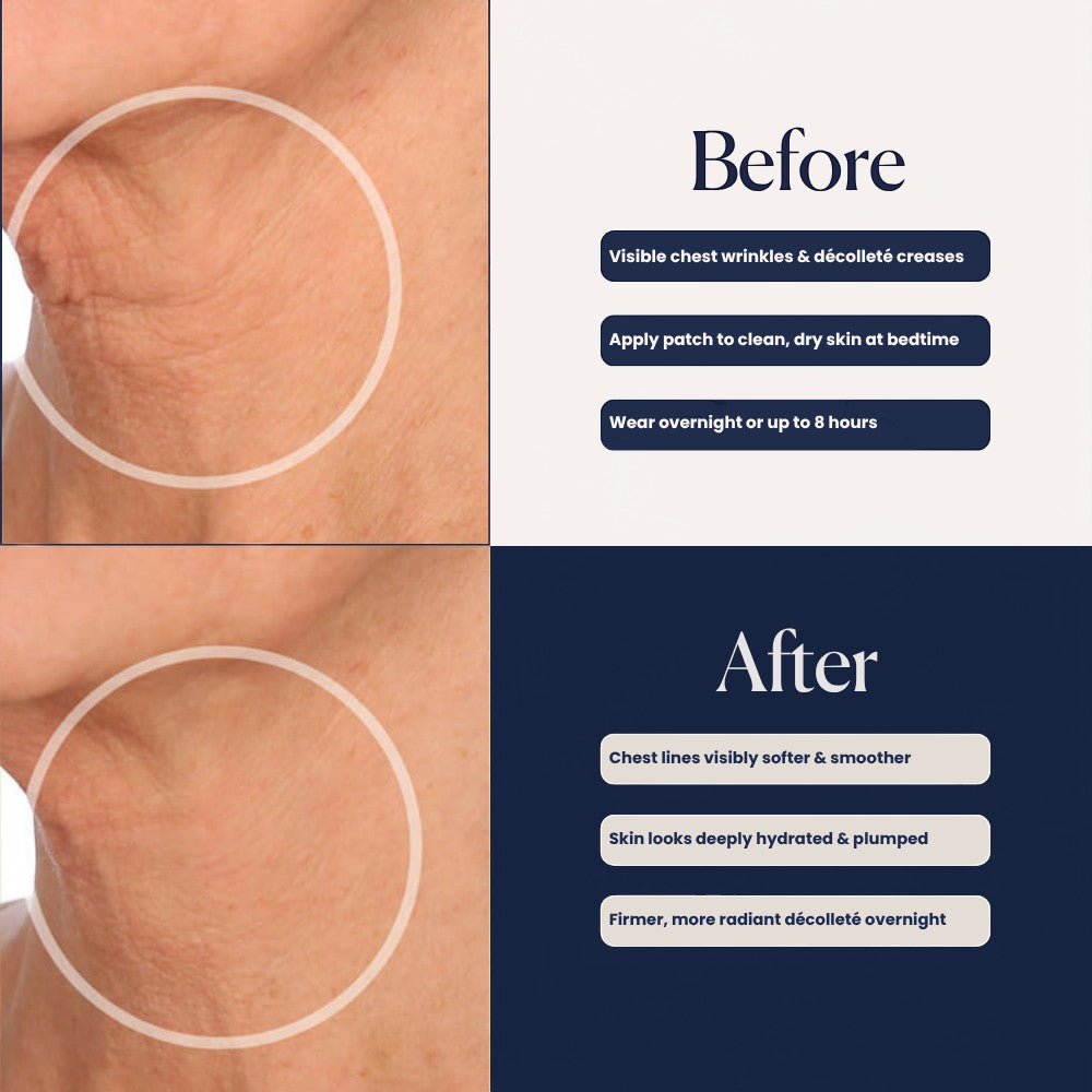 SIO Beauty Neck Hydroseal Patch before and after results showing smoother, hydrated neck skin and reduced wrinkles.
